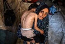 Phóng viên BBC ám ảnh với hình ảnh trẻ em Palestine bị suy dinh dưỡng vì đạn pháo của Israel