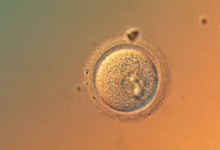 Lần đầu chỉnh sửa chính xác gene phôi người
