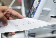 EKG là gì? Khám phá công dụng và ý nghĩa của xét nghiệm tim phổ biến này EKG là gì? Khám phá công dụng và ý nghĩa của xét nghiệm tim phổ biến này
