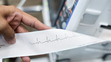 EKG là gì? Khám phá công dụng và ý nghĩa của xét nghiệm tim phổ biến này