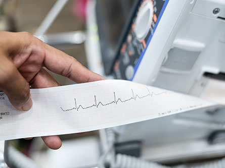 EKG là gì? Khám phá công dụng và ý nghĩa của xét nghiệm tim phổ biến này EKG là gì? Khám phá công dụng và ý nghĩa của xét nghiệm tim phổ biến này